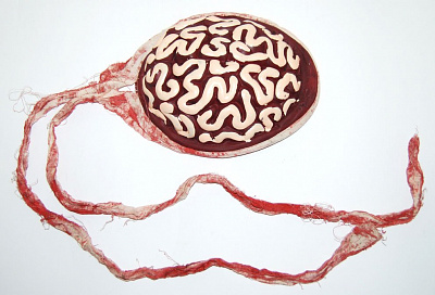 Кровавые мозги